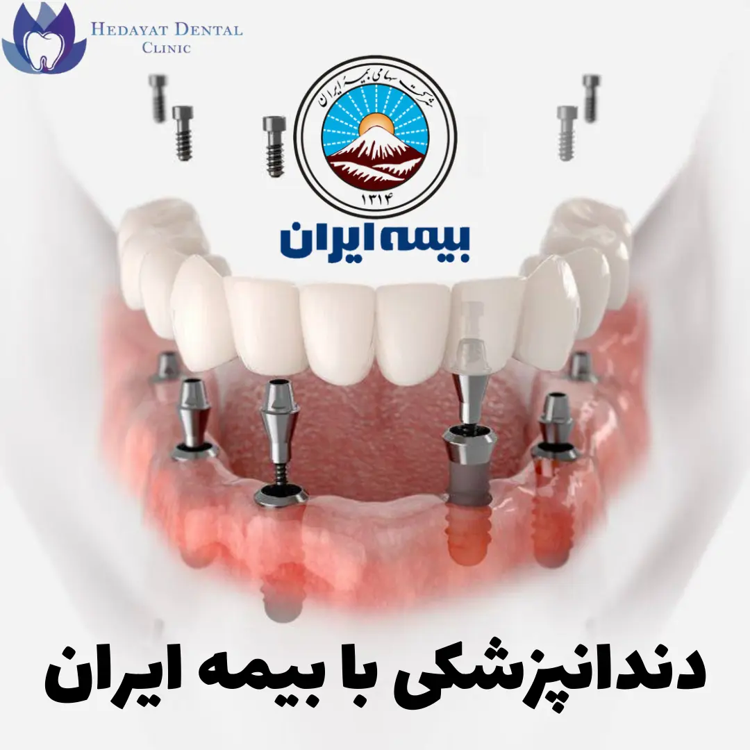 دندانپزشکی با بیمه ایران